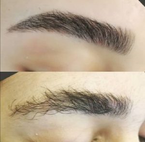 اصلاح صورت و ابرو تخصصی در قزوین
