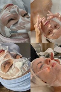 فیشیال صورت چیست در مزایای آن در قزوین