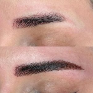 قبل و بعد در ریموو ابرو در ملک بیوتی قزوین